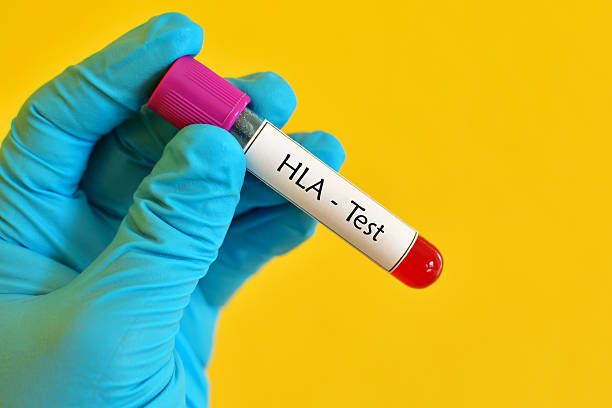 hla testing